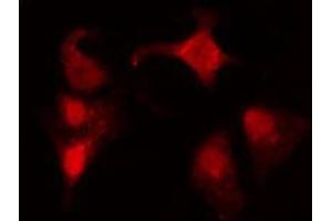 ABIN6274141 staining COLO205 cells by IF/ICC. (ZNF682 抗体  (N-Term))
