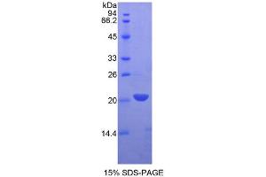 SDS-PAGE analysis of Rat LECT2 Protein. (LECT2 蛋白)