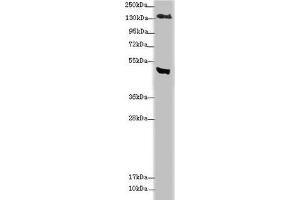 Western blot All lanes: MTUS1 antibody at 3. (MTUS1 抗体  (AA 1041-1270))