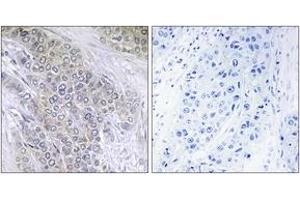 Immunohistochemistry (IHC) image for anti-B-Cell CLL/lymphoma 2 (BCL2) (AA 26-75), (pThr56) antibody (ABIN1531787)