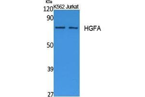 Western Blotting (WB) image for anti-Hepatocyte Growth Factor Activator (HGFA) (C-Term) antibody (ABIN3178102) (HGFA 抗体  (C-Term))
