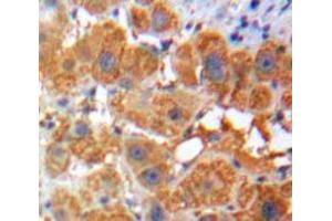 Used in DAB staining on fromalin fixed paraffin-embedded Liver tissue (Apolipoprotein F 抗体  (AA 111-314))