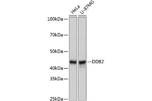 Western blot analysis of extracts of various cell lines, using DDB2 Rabbit mAb (ABIN7266674) at 1:1000 dilution. (DDB2 抗体)