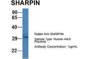 Host: Rabbit Target Name: CHAD Sample Type: Human Adult Placenta Antibody Dilution: 1. (SHARPIN 抗体  (C-Term))