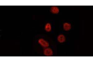 ABIN6277777 staining HepG2 by IF/ICC. (LEF1 抗体  (Internal Region))