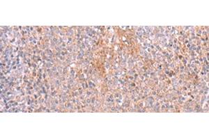 Immunohistochemistry of paraffin-embedded Human tonsil tissue using ZSWIM1 Polyclonal Antibody at dilution of 1:55(x200) (ZSWIM1 抗体)
