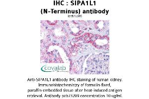 Image no. 1 for anti-Signal-Induced Proliferation-Associated 1 Like 1 (SIPA1L1) (N-Term) antibody (ABIN1739266) (SIPA1L1 抗体  (N-Term))