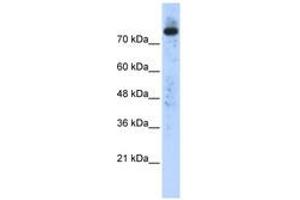 Image no. 1 for anti-Phospholipase D2 (PLD2) (N-Term) antibody (ABIN6740534) (Phospholipase D2 抗体  (N-Term))