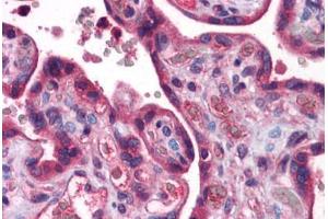 Human Placenta: Formalin-Fixed, Paraffin-Embedded (FFPE) (ACSL1 抗体  (AA 619-668))