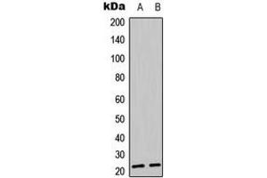 Western blot analysis of BIK (pT33) expression in Jarkat (A), K562 (B) whole cell lysates.