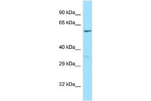 WB Suggested Anti-PLCXD1 Antibody Titration: 1. (PLCXD1 抗体  (C-Term))
