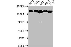 Western Blot Positive WB detected in: 293T whole cell lysate, Hela whole cell lysate, L02 whole cell lysate, PC-3 whole cell lysate, A549 whole cell lysate All lanes: MET antibody at 1:1500 Secondary Goat polyclonal to rabbit IgG at 1/50000 dilution Predicted band size: 156, 158, 86 kDa Observed band size: 156 kDa (Recombinant c-MET 抗体)