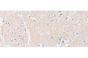 Immunohistochemistry of paraffin-embedded Human brain tissue using TPD52L3 Polyclonal Antibody at dilution of 1:160(x200) (TPD52L3 抗体)