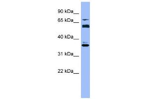 WB Suggested Anti-CYP2B6 Antibody Titration:  0. (CYP2B6 抗体  (Middle Region))