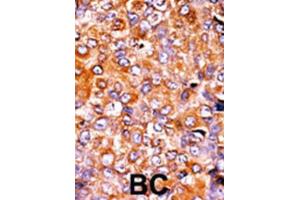 Immunohistochemistry (IHC) image for anti-Myelin Transcription Factor 1 (MYT1) (pThr495) antibody (ABIN3001766) (MYT1 抗体  (pThr495))