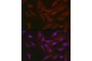 Immunofluorescence analysis of NIH/3T3 cells using RIPK3 Rabbit pAb (ABIN6132598, ABIN6146964, ABIN6146967 and ABIN6221084) at dilution of 1:50 (40x lens). (RIPK3 抗体  (AA 1-120))