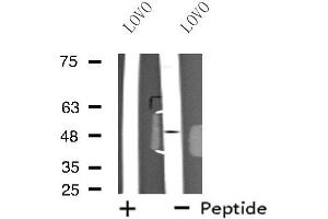 Western blot analysis of extracts from LOVO cells, using MOT4 antibody. (SLC16A3 抗体  (Internal Region))