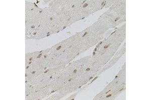 Immunohistochemistry of paraffin-embedded mouse heart using SFRS9 antibody. (SFRS9 抗体)