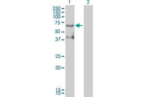 Western Blot analysis of ETV4 expression in transfected 293T cell line by ETV4 monoclonal antibody (M01), clone 3G9-1B9. (ETV4 抗体  (AA 1-207))
