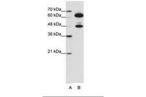 Image no. 1 for anti-Small Nuclear Ribonucleoprotein 70kDa (U1) (SNRNP70) (AA 301-350) antibody (ABIN6736194) (SNRNP70 抗体  (AA 301-350))