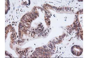 Image no. 8 for anti-Excision Repair Cross-Complementing Rodent Repair Deficiency, Complementation Group 4 (ERCC4) antibody (ABIN1498070)