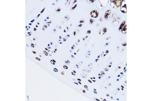 Immunohistochemistry of paraffin-embedded Rat leg bone using PTH1R Rabbit pAb (ABIN3022477, ABIN3022478, ABIN3022479, ABIN1513445 and ABIN6218844) at dilution of 1:100 (40x lens). (PTH1R 抗体  (AA 464-593))