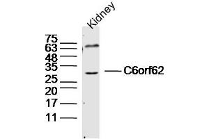 Mouse kidney lysates probed with C6orf62 Polyclonal Antibody, Unconjugated  at 1:300 dilution and 4˚C overnight incubation. (C6ORF62 抗体  (AA 1-100))