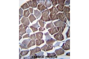 NPHP3 Antibody (N-term) immunohistochemistry analysis in formalin fixed and paraffin embedded human skeletal muscle followed by peroxidase conjugation of the secondary antibody and DAB staining. (NPHP3 抗体  (N-Term))