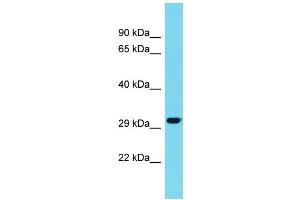 Host: Rabbit Target Name: METRNL Sample Type: Fetal Liver lysates Antibody Dilution: 1. (METRNL 抗体  (C-Term))