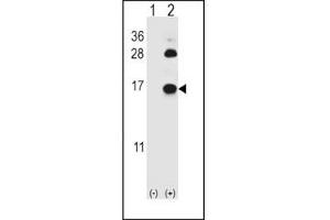 Western blot analysis of FABP4 antibody and 293 cell lysate (2 ug/lane) either nontransfected (Lane 1) or transiently transfected (2) with the FABP4 gene.