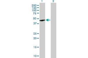 Western Blot analysis of GPR143 expression in transfected 293T cell line by GPR143 MaxPab polyclonal antibody. (GPR143 抗体  (AA 1-424))