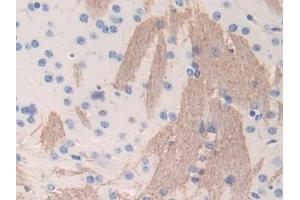 Detection of FGB in Mouse Cerebrum Tissue using Polyclonal Antibody to Fibrinogen Beta Chain (FGB) (Fibrinogen beta Chain 抗体  (AA 35-481))