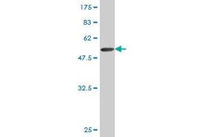Western Blot detection against Immunogen (51. (TK1 抗体  (AA 1-234))