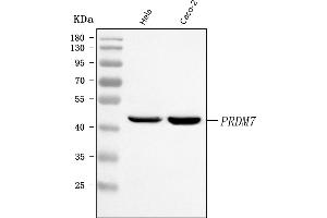 Western blot analysis of PRDM7 using anti-PRDM7 antibody (ABIN7601682).