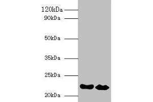 Western blot All lanes: IFNA21 antibody at 2 μg/mL Lane 1: NIH/3T3 whole cell lysate Lane 2: HepG2 whole cell lysate Secondary Goat polyclonal to rabbit IgG at 1/10000 dilution Predicted band size: 22 kDa Observed band size: 22 kDa (IFNA21 抗体  (AA 24-189))