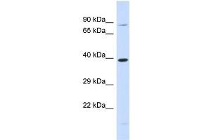Host:  Rabbit  Target Name:  RHBDL2  Sample Type:  293T Whole Cell lysates  Antibody Dilution:  1. (RHBDL2 抗体  (N-Term))