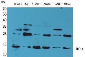 Western Blotting (WB) image for anti-Thioredoxin Domain Containing 17 (TXNDC17) (Tyr796) antibody (ABIN3178162) (TXNDC17 抗体  (Tyr796))