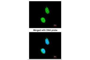 Immunofluorescence (IF) image for anti-Excision Repair Cross-Complementing Rodent Repair Deficiency, Complementation Group 8 (ERCC8) (Center) antibody (ABIN2857074)