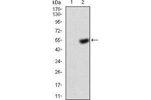 Western blot analysis using KBTBD8 mAb =against HEK293 (1) and KBTBD8 (AA: 264-464)-hIgGFc transfected HEK293 (2) cell lysate. (KBTBD8 抗体  (AA 264-464))