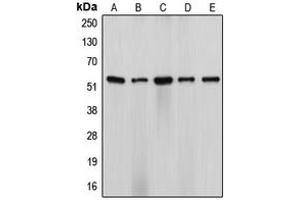 Western blot analysis of Cytochrome P450 17A1 expression in HeLa (A), NIH3T3 (B), H9C2 (C), SW13 (D), ES2 (E) whole cell lysates. (CYP17A1 抗体  (Center))