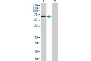 Western Blot analysis of STK38L expression in transfected 293T cell line by STK38L MaxPab polyclonal antibody. (STK38L 抗体  (AA 1-464))