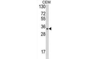 Western Blotting (WB) image for anti-Developmental Pluripotency Associated 4 (DPPA4) antibody (ABIN2997956) (DPPA4 抗体)