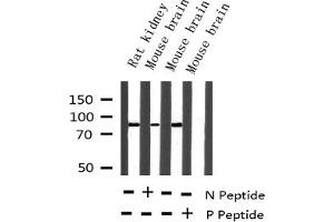 Western blot analysis of Phospho-Tau (Ser396) expression in various lysates (MAPT 抗体  (pSer396))