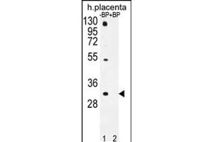 Western blot analysis of OR1D5 Antibody Pab pre-incubated without(lane 1) and with(lane 2) blocking peptide in human placenta tissue lysate. (OR1D5 抗体  (C-Term))