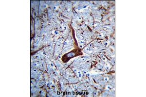 P2 Antibody (Ascites) ABIN659033 immunohistochemistry analysis in forlin fixed and paraffin embedded hun brain tissue followed by peroxidase conjμgation of the secondary antibody and DAB staining. (MAP2 抗体)