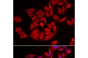 Immunofluorescence analysis of U2OS cells using TLK2 Polyclonal Antibody (TLK2 抗体)