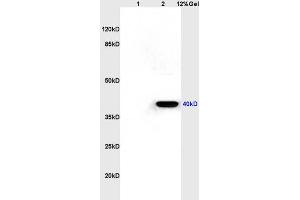 Lane 1: rat kidney lysates Lane 2: rat brain lysates probed with Anti CXCR1/IL-8RA Polyclonal Antibody, Unconjugated (ABIN730873) at 1:200 in 4 °C. (CXCR1 抗体  (AA 186-280))