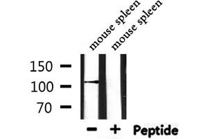 Western blot analysis of extracts from mouse spleen, using DPYD Antibody.