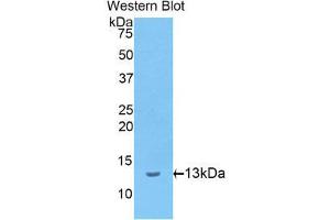 Western Blotting (WB) image for anti-Involucrin (IVL) (AA 461-551) antibody (ABIN1174489) (Involucrin 抗体  (AA 461-551))