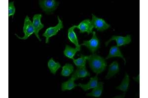 Immunofluorescence staining of A549 cells with ABIN7171705 at 1:33, counter-stained with DAPI.